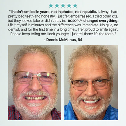 🔥🔥🔥Ends Today: 70% OFF!🦷DarkFairy™ Custom-Fit Full Functional Dentures Make you more confident